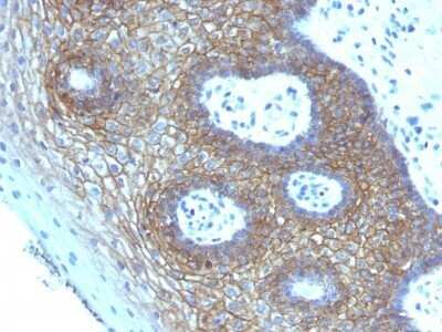 CD44 Antibody (CD44v4/1219) - variant 4