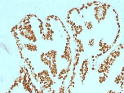 HNF-3 alpha/FoxA1 Antibody (FOXA1/1515)
