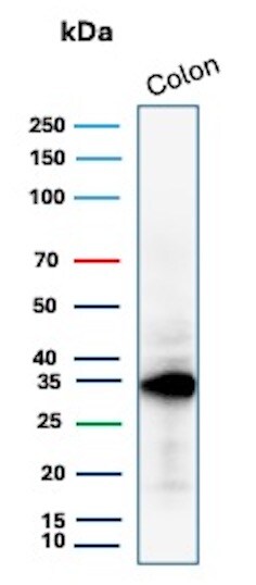 Calponin 1 Antibody (CNN1/1408R) - Azide and BSA Free Western Blot: Calponin 1 Antibody (CNN1/1408R) - Azide and BSA Free [NBP2-54378] -