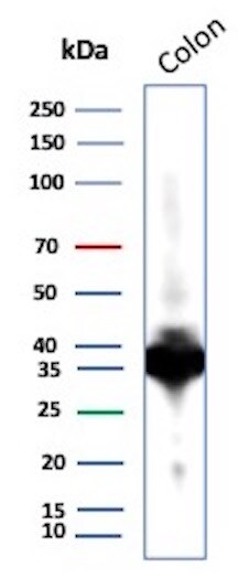 Calponin 1 Antibody (CNN1/1408R) - Azide and BSA Free Western Blot: Calponin 1 Antibody (CNN1/1408R) - Azide and BSA Free [NBP2-54378] -