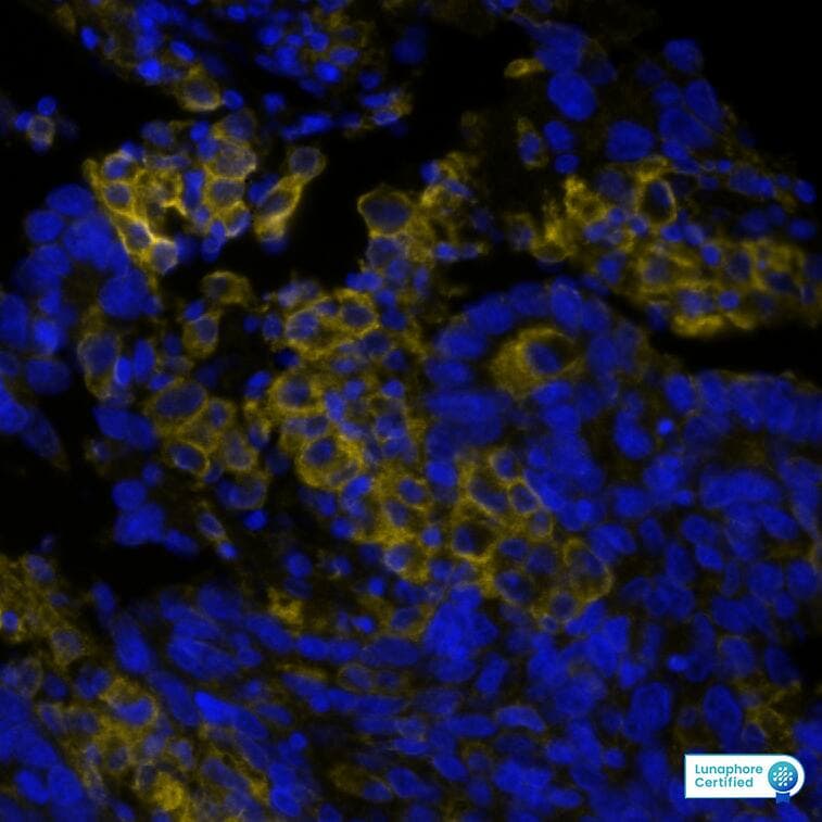 PD-L1 Antibody (PDL1/8809R) - Azide and BSA Free PD-L1 Antibody (PDL1/8809R) PD-L1 in Human Lung Tumor via seqIF� staining on COMET�
