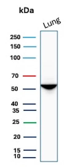 Serpin A1/alpha 1-Antitrypsin Antibody (AAT/1379) - Azide and BSA Free Western Blot: Serpin A1/alpha 1-Antitrypsin Antibody (AAT/1379) - Azide and BSA Free [NBP2-54442] -