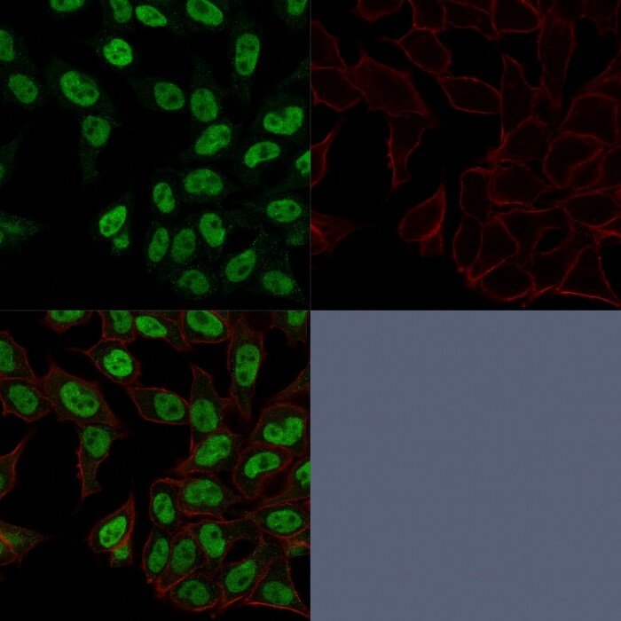 TOP2A Antibody (TOP2A/1362) - Azide and BSA Free Immunocytochemistry/ Immunofluorescence: TOP2A Antibody (TOP2A/1362) - Azide and BSA Free [NBP2-54545] -
