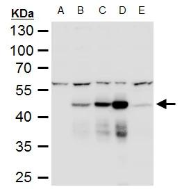 Dengue Virus NS1 protein Antibody - BSA Free