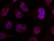 Histone Deacetylase 4/HDAC4 [p Ser632] Antibody - BSA Free