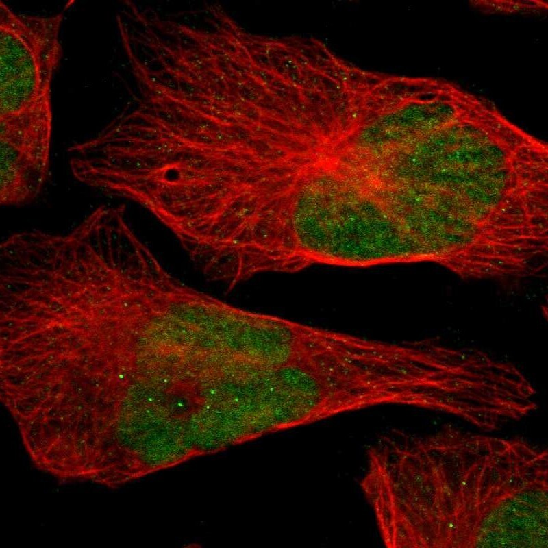 APE Antibody - BSA Free Immunocytochemistry/ Immunofluorescence: APE Antibody [NBP2-54653]