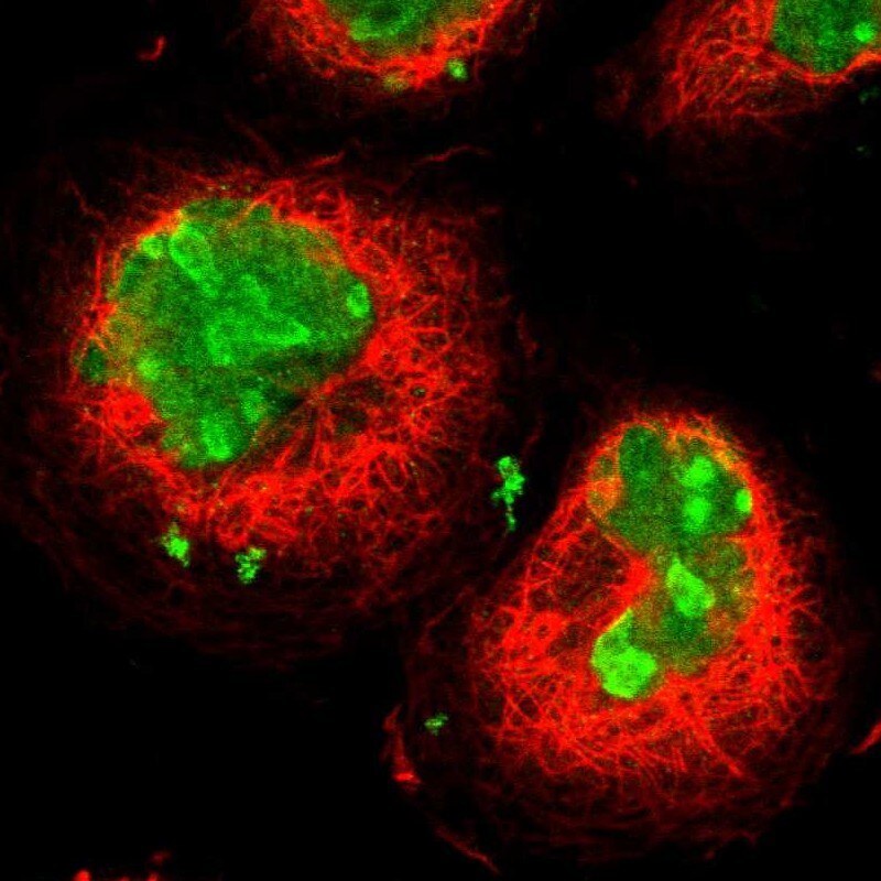 Ki67/MKI67 Antibody - BSA Free Immunocytochemistry/ Immunofluorescence: Ki67/MKI67 Antibody [NBP2-54656]