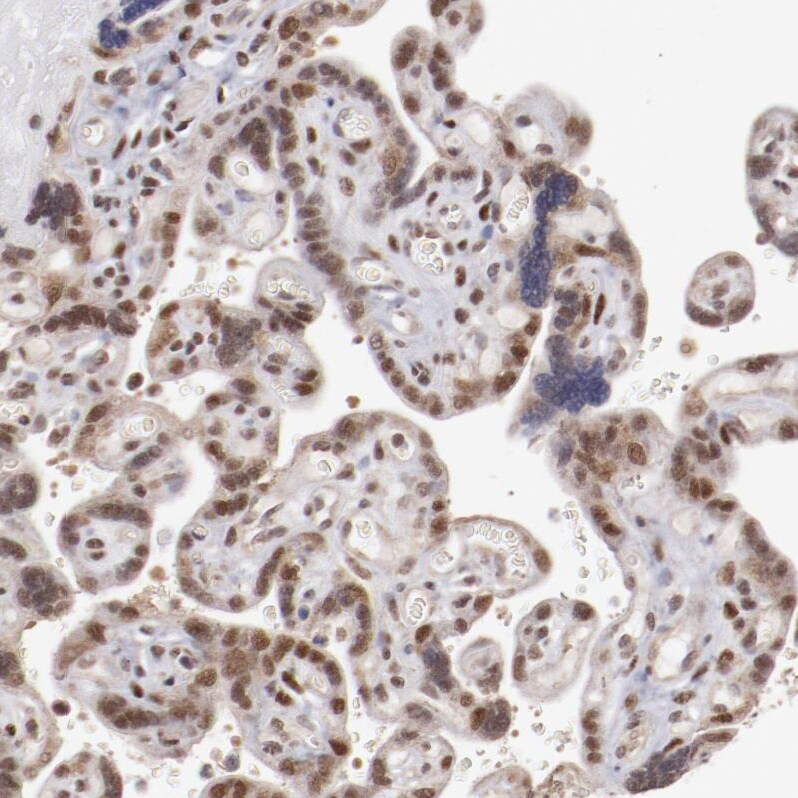 ARNT/HIF-1 beta Antibody - BSA Free Immunohistochemistry-Paraffin: ARNT/HIF-1 beta Antibody [NBP2-54663]