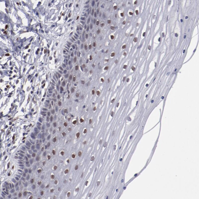 ARNT/HIF-1 beta Antibody - BSA Free Immunohistochemistry-Paraffin: ARNT/HIF-1 beta Antibody [NBP2-54663]