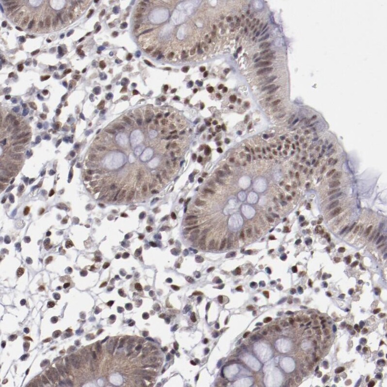 ARNT/HIF-1 beta Antibody - BSA Free Immunohistochemistry-Paraffin: ARNT/HIF-1 beta Antibody [NBP2-54663]