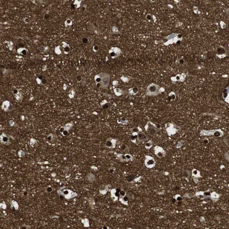 GAP-43 Antibody - BSA Free Immunohistochemistry-Paraffin: GAP-43 Antibody [NBP2-54671]