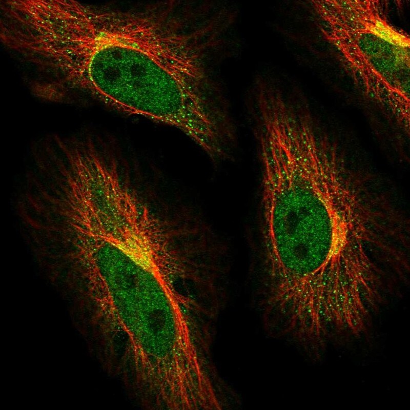 ABCG1 Antibody - BSA Free Immunocytochemistry/ Immunofluorescence: ABCG1 Antibody - BSA Free [NBP2-54681]