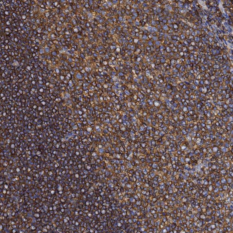 beta-Actin Antibody - BSA Free Immunohistochemistry-Paraffin: beta-Actin Antibody [NBP2-54690]