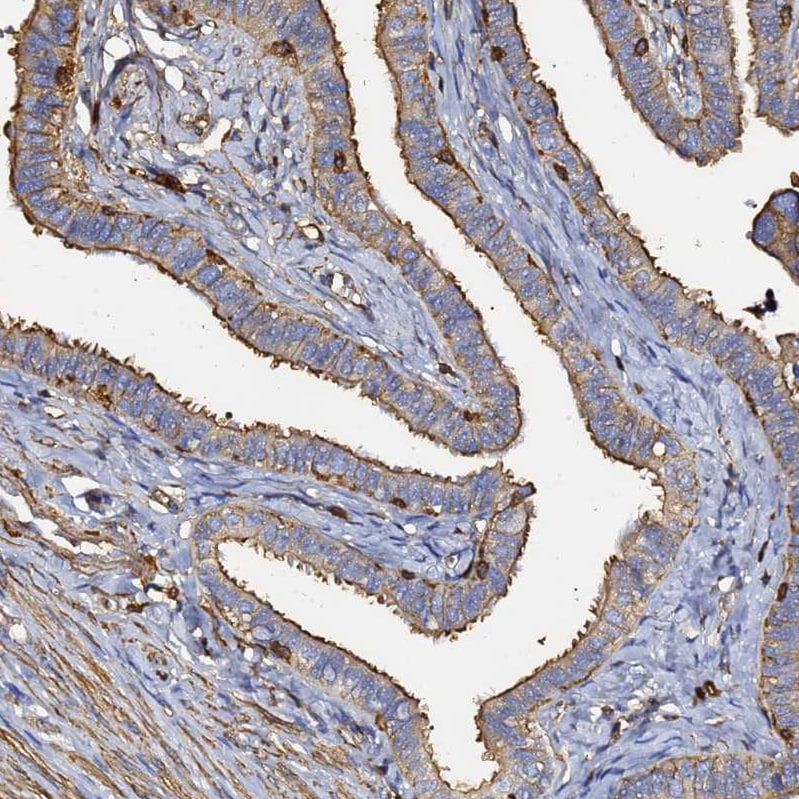 beta-Actin Antibody - BSA Free Immunohistochemistry-Paraffin: beta-Actin Antibody [NBP2-54690]