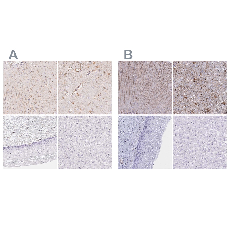 GFAP Antibody Immunohistochemistry-Paraffin: GFAP Antibody Antibody [NBP2-54748]
