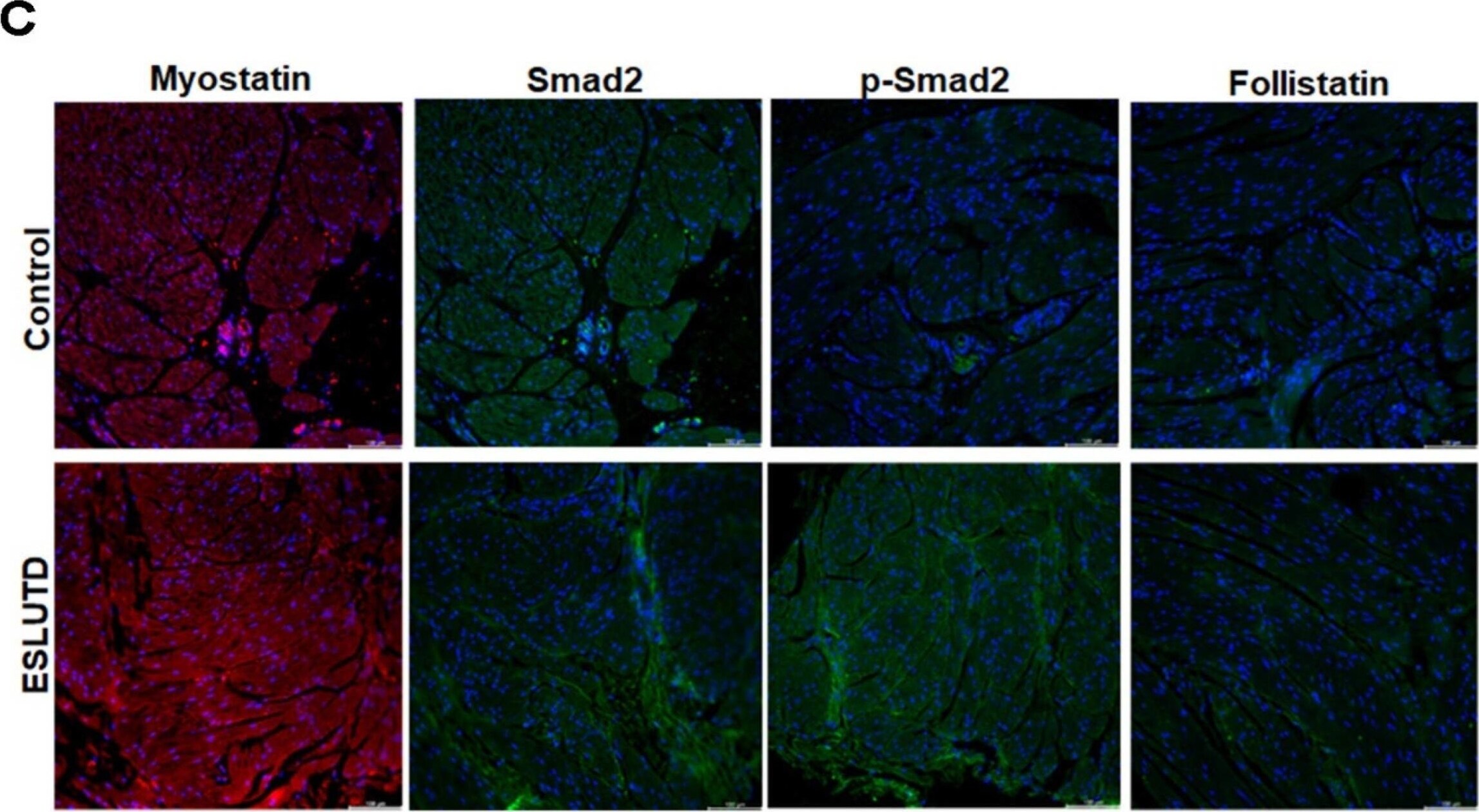 Smad2 [p Ser467] Antibody - BSA Free