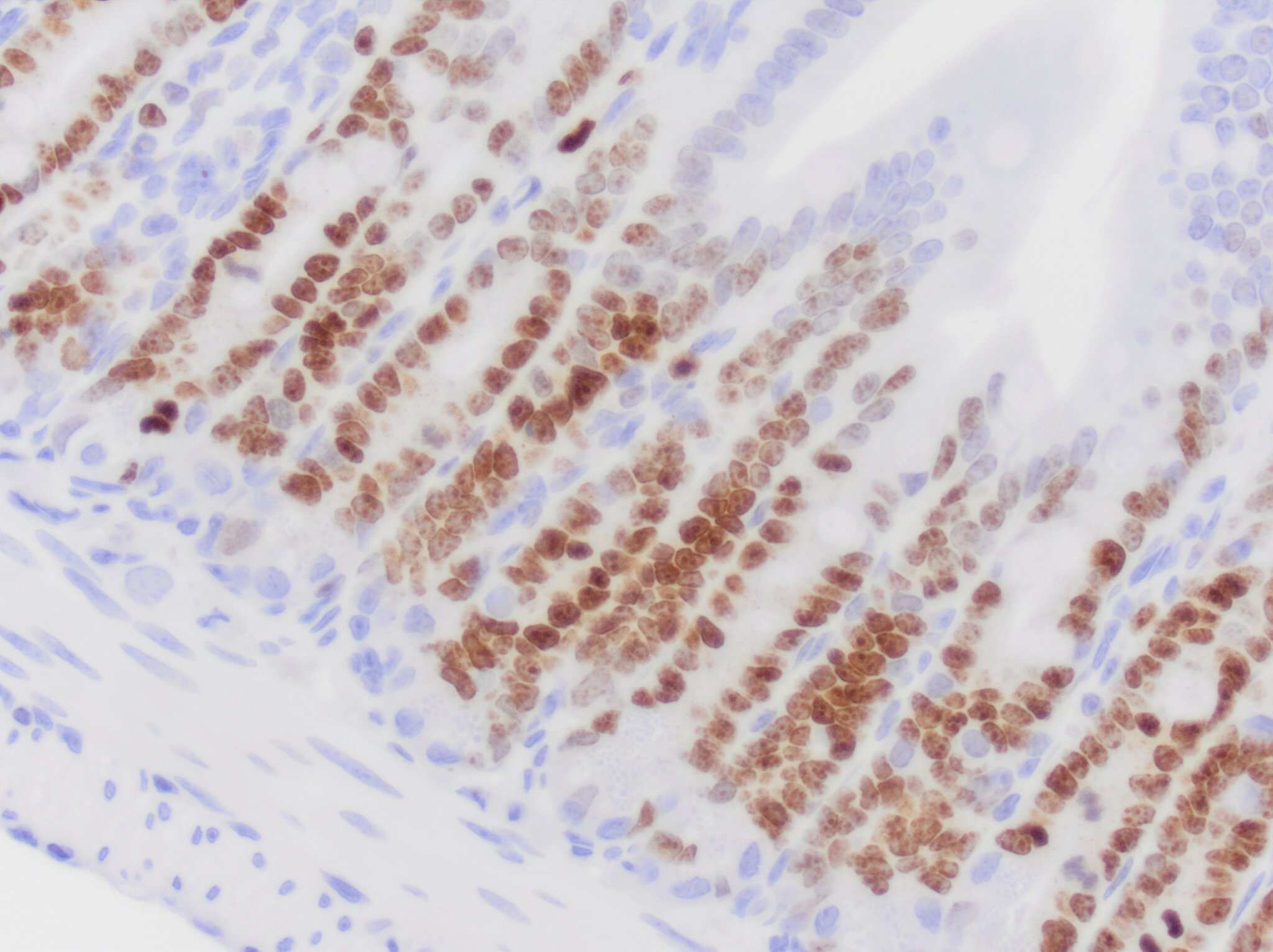 Ki67/MKI67 Antibody (1297A) - BSA Free