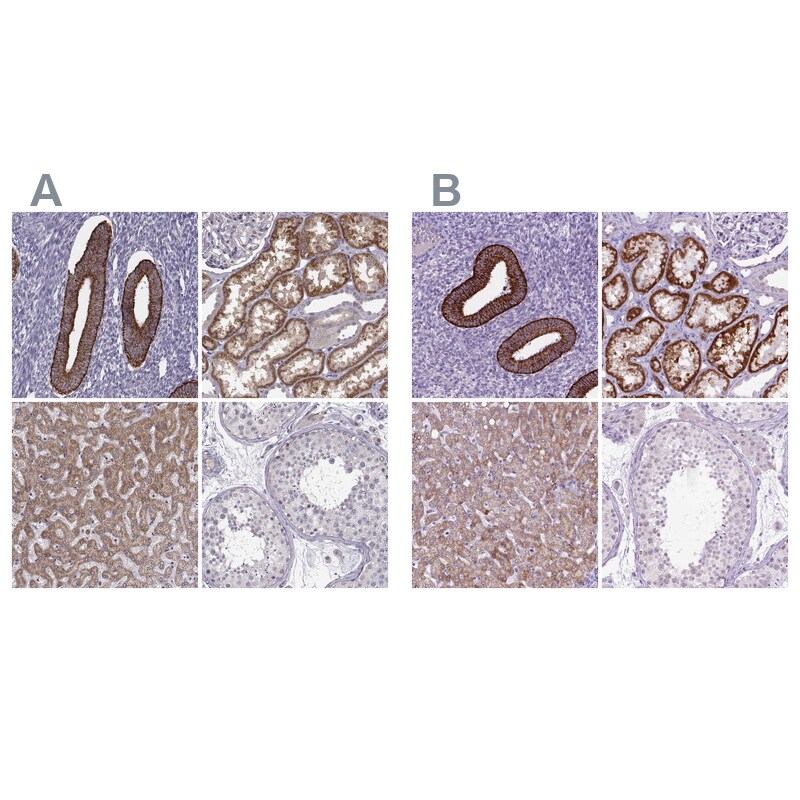 Kynurenine 3-Monooxygenase/KMO Antibody Immunohistochemistry-Paraffin: Kynurenine 3-Monooxygenase/KMO Antibody Antibody [NBP2-54915]