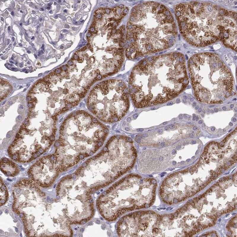 Kynurenine 3-Monooxygenase/KMO Antibody Immunohistochemistry-Paraffin: Kynurenine 3-Monooxygenase/KMO Antibody [NBP2-54915]