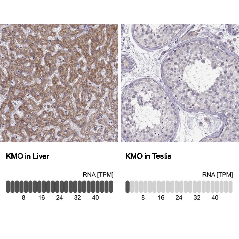 Kynurenine 3-Monooxygenase/KMO Antibody Immunohistochemistry-Paraffin: Kynurenine 3-Monooxygenase/KMO Antibody [NBP2-54915]