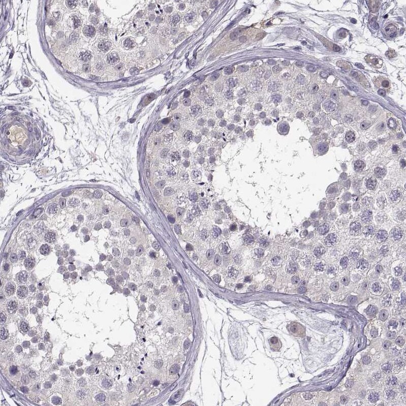 Kynurenine 3-Monooxygenase/KMO Antibody Immunohistochemistry-Paraffin: Kynurenine 3-Monooxygenase/KMO Antibody [NBP2-54915]