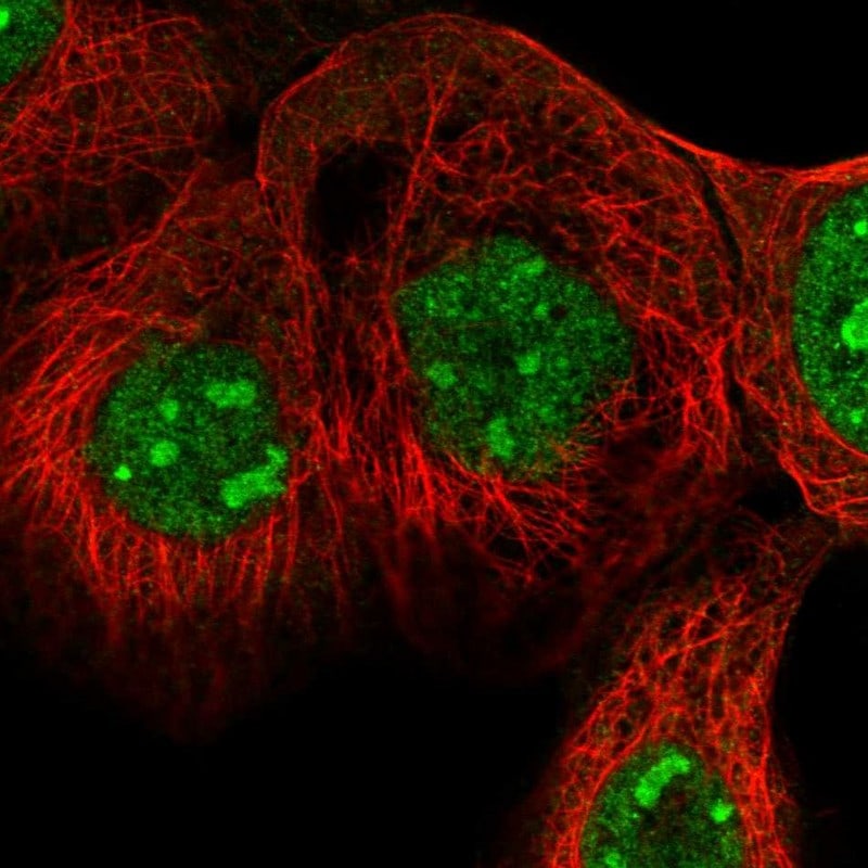 Sec8 Antibody - BSA Free Immunocytochemistry/ Immunofluorescence: Sec8 Antibody - BSA Free [NBP2-54921]