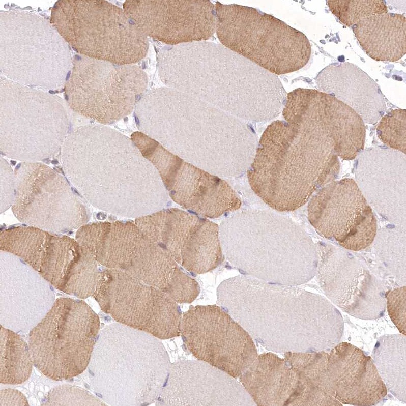 Aminopeptidase B/RNPEP Antibody - BSA Free Immunohistochemistry-Paraffin: Aminopeptidase B/RNPEP Antibody [NBP2-54975]