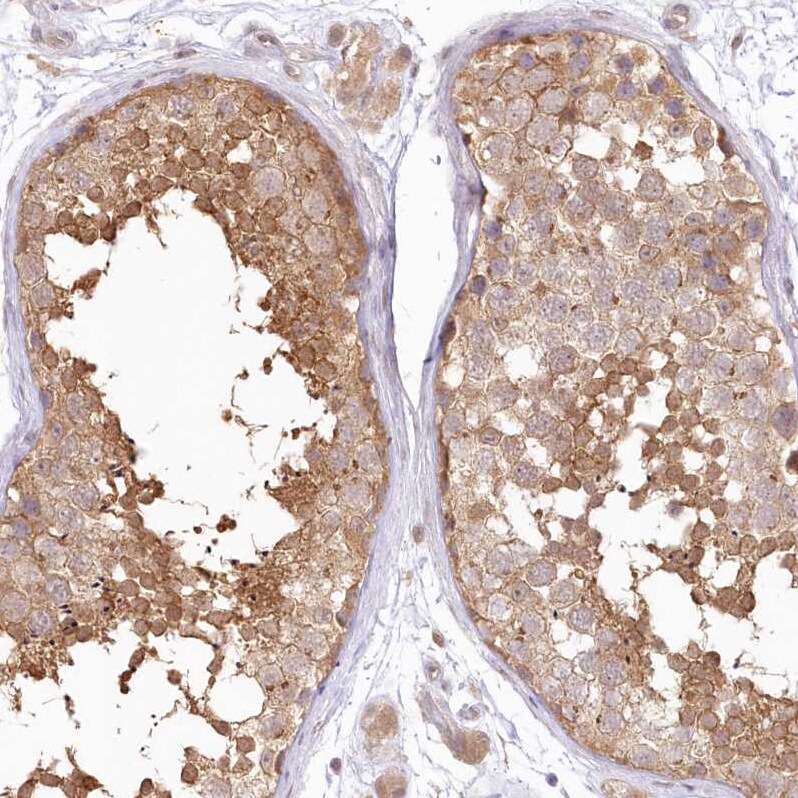 Aminopeptidase B/RNPEP Antibody - BSA Free Immunohistochemistry-Paraffin: Aminopeptidase B/RNPEP Antibody [NBP2-54975]