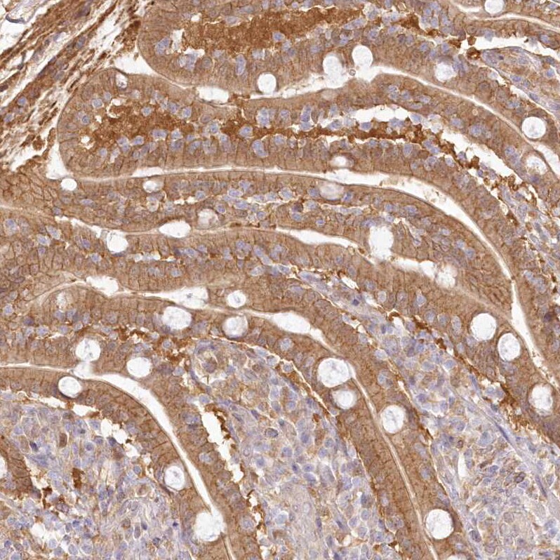 Aminopeptidase B/RNPEP Antibody - BSA Free Immunohistochemistry-Paraffin: Aminopeptidase B/RNPEP Antibody [NBP2-54975]