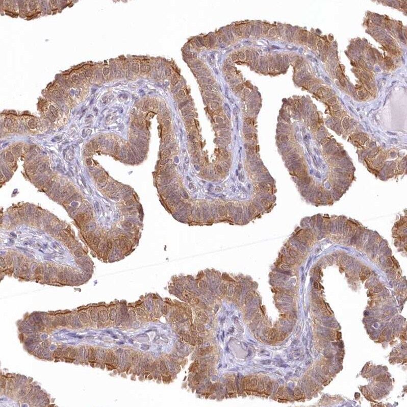 Aminopeptidase B/RNPEP Antibody - BSA Free Immunohistochemistry-Paraffin: Aminopeptidase B/RNPEP Antibody [NBP2-54975]