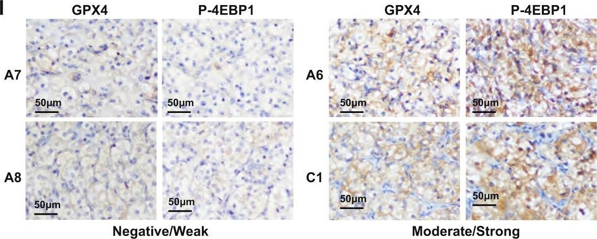 Glutathione Peroxidase 4/GPX4 Antibody