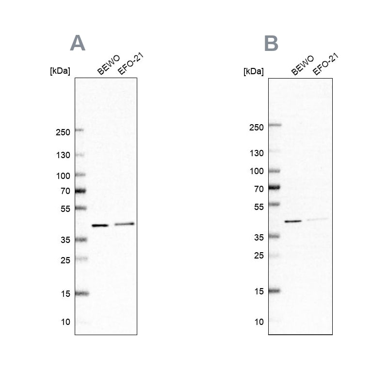 PCBP1 Antibody Western Blot: PCBP1 Antibody Antibody [NBP2-55063]
