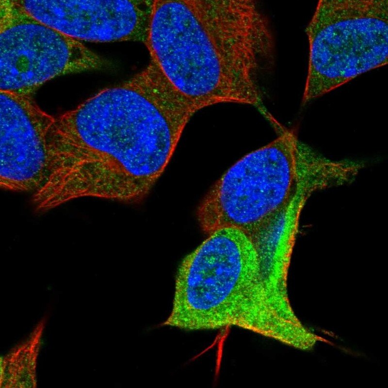 Doublecortin Antibody - BSA Free Immunocytochemistry/ Immunofluorescence: Doublecortin Antibody - BSA Free [NBP2-55074]