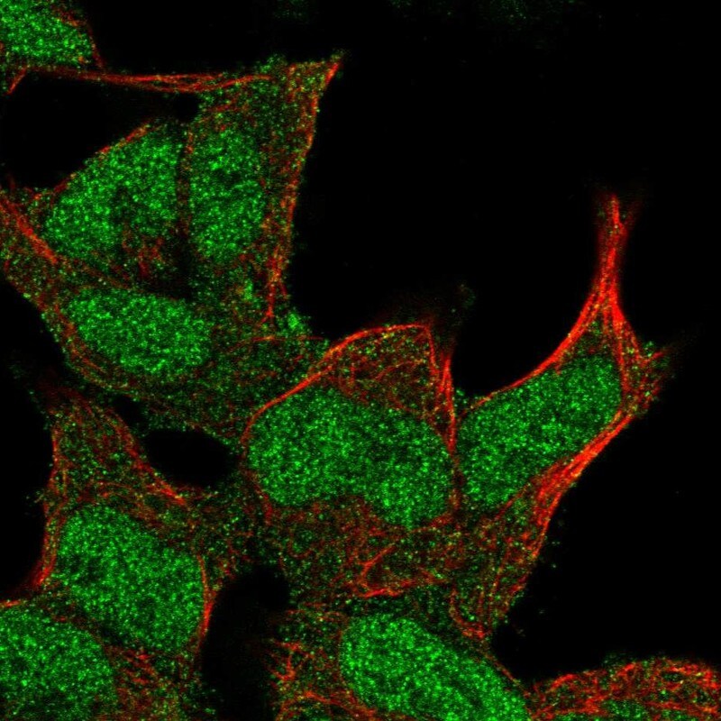 DMAP1 Antibody - BSA Free Immunocytochemistry/ Immunofluorescence: DMAP1 Antibody [NBP2-55093]