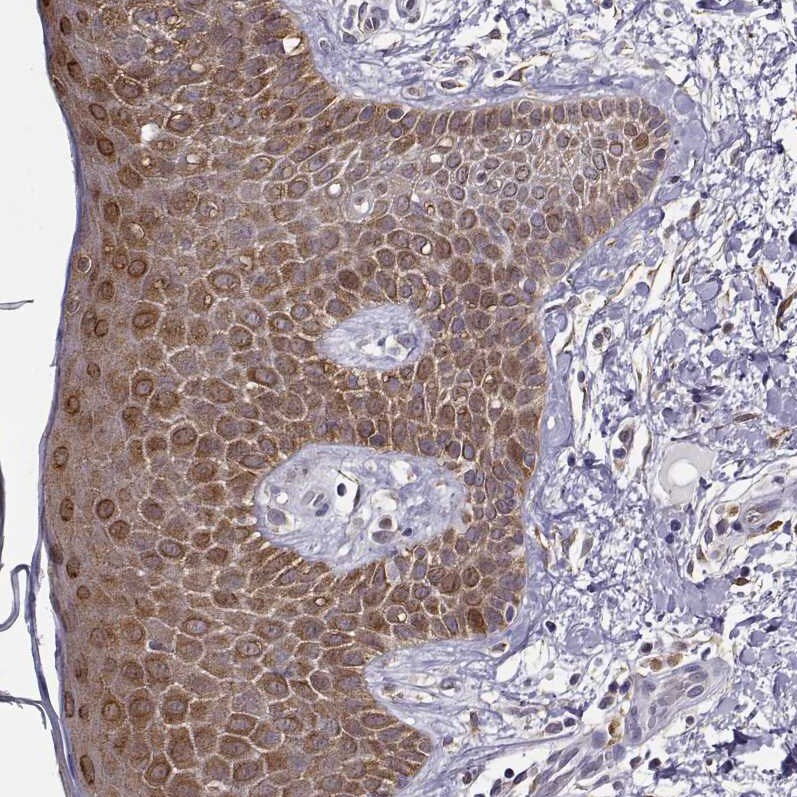 BACH1 Antibody - BSA Free Immunohistochemistry-Paraffin: BACH1 Antibody [NBP2-55113]