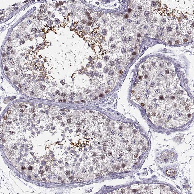 BACH1 Antibody - BSA Free Immunohistochemistry-Paraffin: BACH1 Antibody [NBP2-55113]