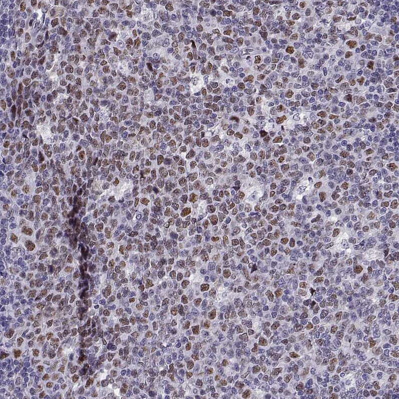 BACH1 Antibody - BSA Free Immunohistochemistry-Paraffin: BACH1 Antibody [NBP2-55113]