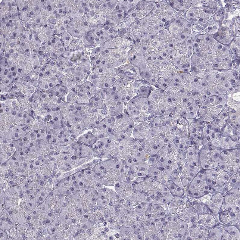 BACH1 Antibody - BSA Free Immunohistochemistry-Paraffin: BACH1 Antibody [NBP2-55113]