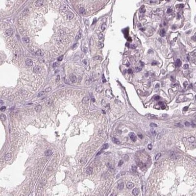 Opticin Antibody - BSA Free Immunohistochemistry-Paraffin: Opticin Antibody [NBP2-55115]