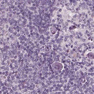 Opticin Antibody - BSA Free Immunohistochemistry-Paraffin: Opticin Antibody [NBP2-55115]