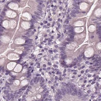 Opticin Antibody - BSA Free Immunohistochemistry-Paraffin: Opticin Antibody [NBP2-55115]