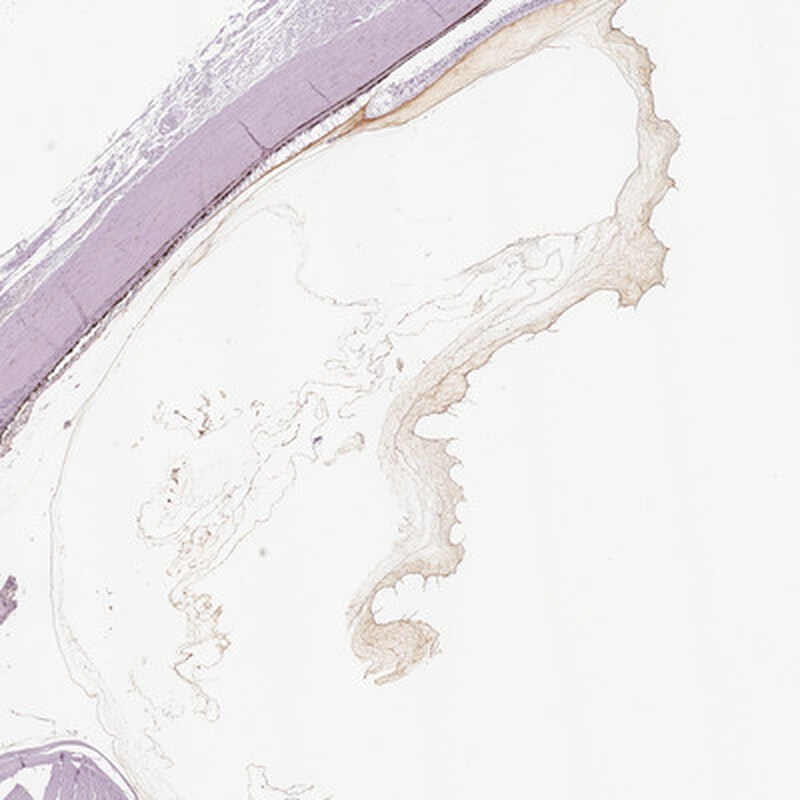 Opticin Antibody - BSA Free Immunohistochemistry-Paraffin: Opticin Antibody [NBP2-55115]
