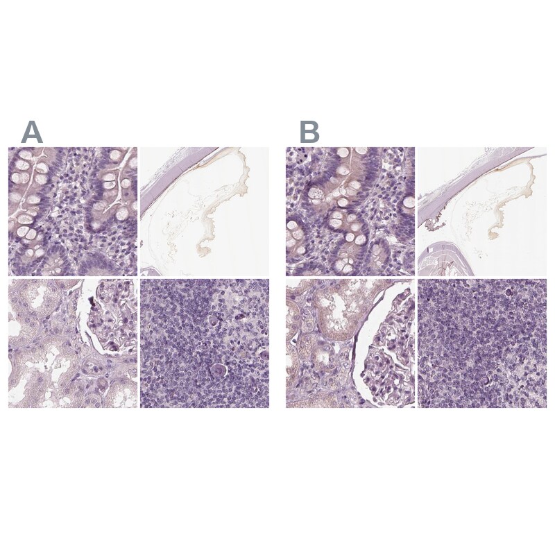 Opticin Antibody - BSA Free Immunohistochemistry-Paraffin: Opticin Antibody [NBP2-55115]