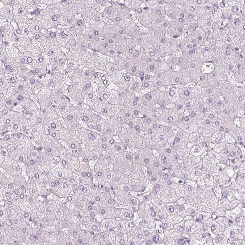 S-arrestin Antibody - BSA Free Immunohistochemistry: S-arrestin Antibody - BSA Free [NBP2-55126]