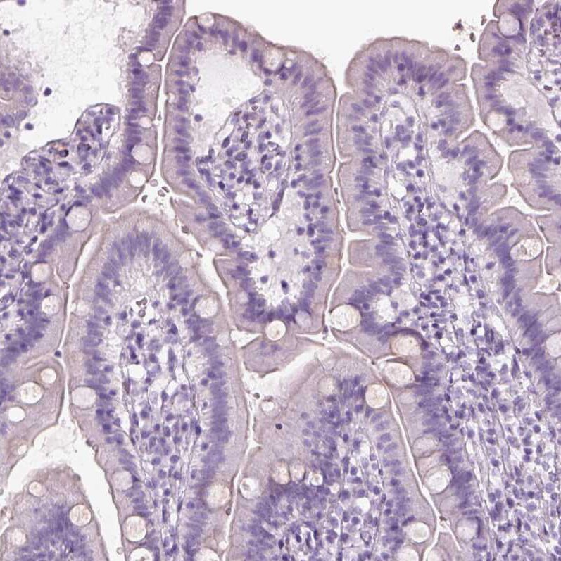 S-arrestin Antibody - BSA Free Immunohistochemistry: S-arrestin Antibody - BSA Free [NBP2-55126]
