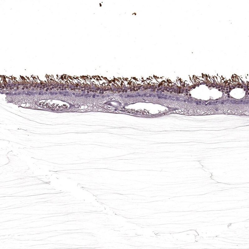 S-arrestin Antibody - BSA Free Immunohistochemistry: S-arrestin Antibody - BSA Free [NBP2-55126]