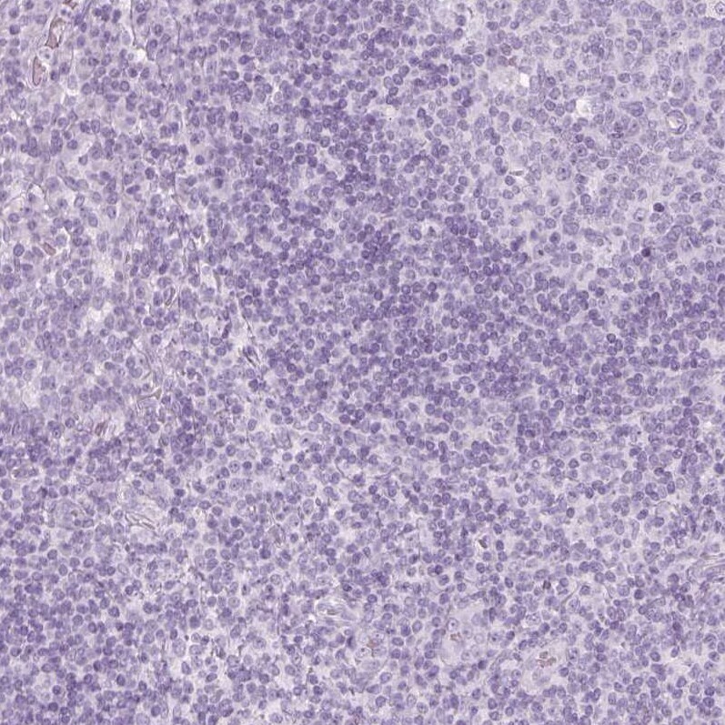 S-arrestin Antibody - BSA Free Immunohistochemistry: S-arrestin Antibody - BSA Free [NBP2-55126]