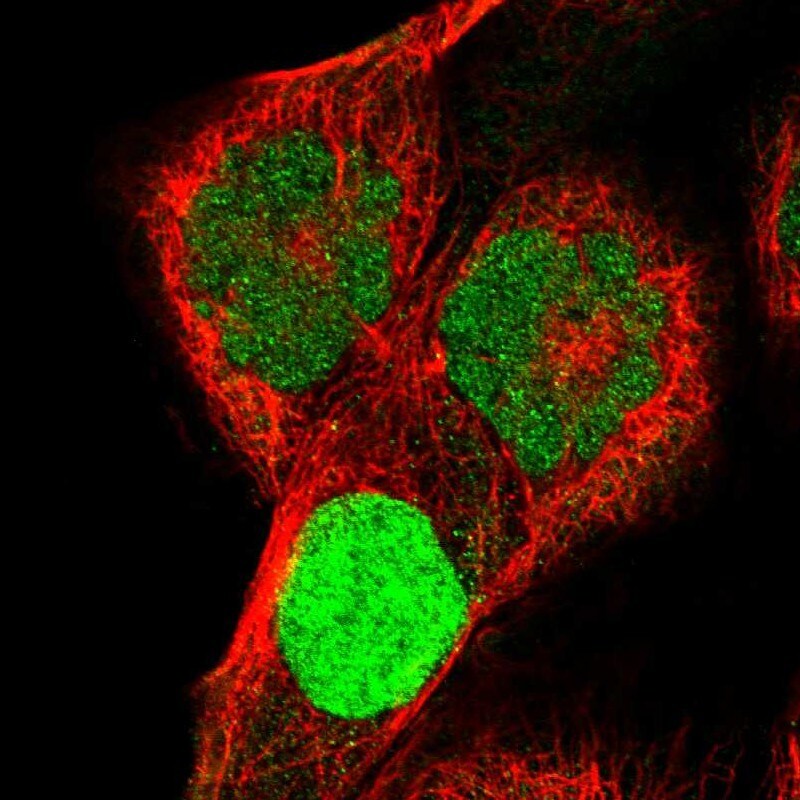 Kv4.1 Antibody - BSA Free Immunocytochemistry/ Immunofluorescence: Kv4.1 Antibody - BSA Free [NBP2-55128]