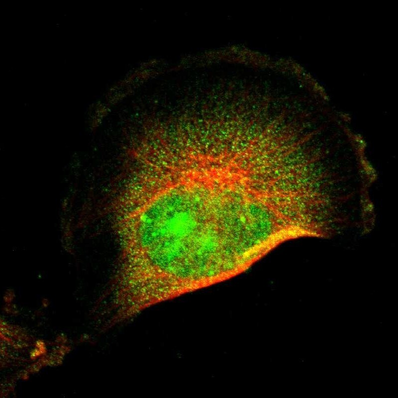 FRMD8 Antibody - BSA Free Immunocytochemistry/ Immunofluorescence: FRMD8 Antibody [NBP2-55142]