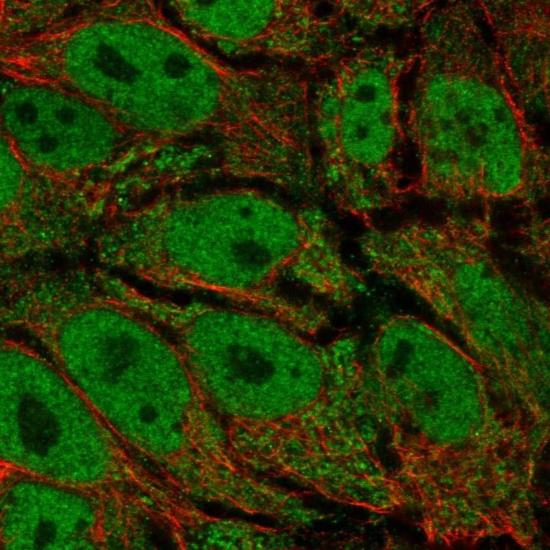 AKR1CL2 Antibody - BSA Free Immunocytochemistry/ Immunofluorescence: AKR1CL2 Antibody - BSA Free [NBP2-55163]